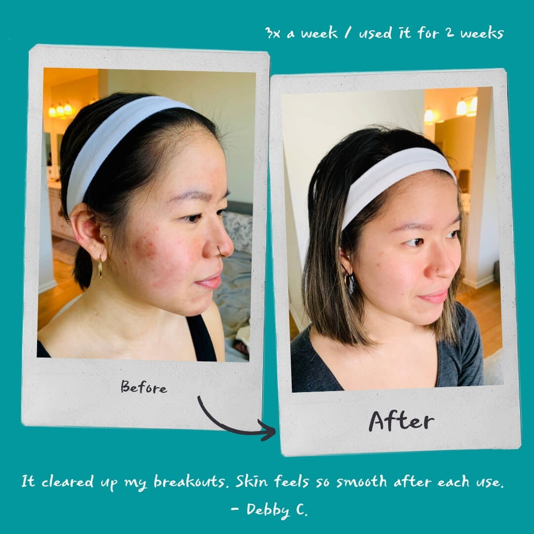 Detoxifying Exfoliating Mask