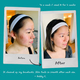 Detoxifying Exfoliating Mask