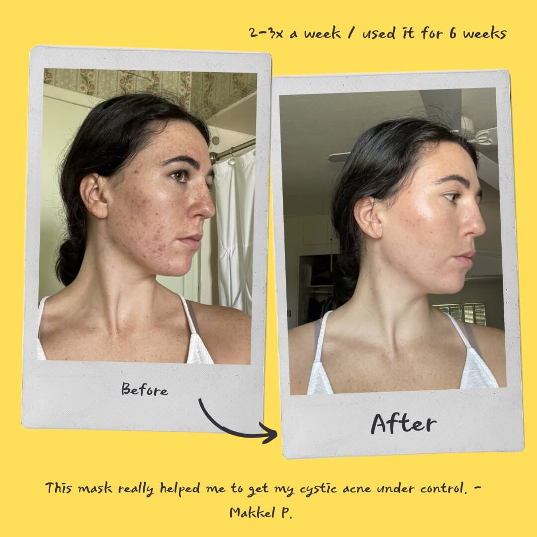 Detoxifying Exfoliating Mask