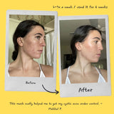 Detoxifying Exfoliating Mask