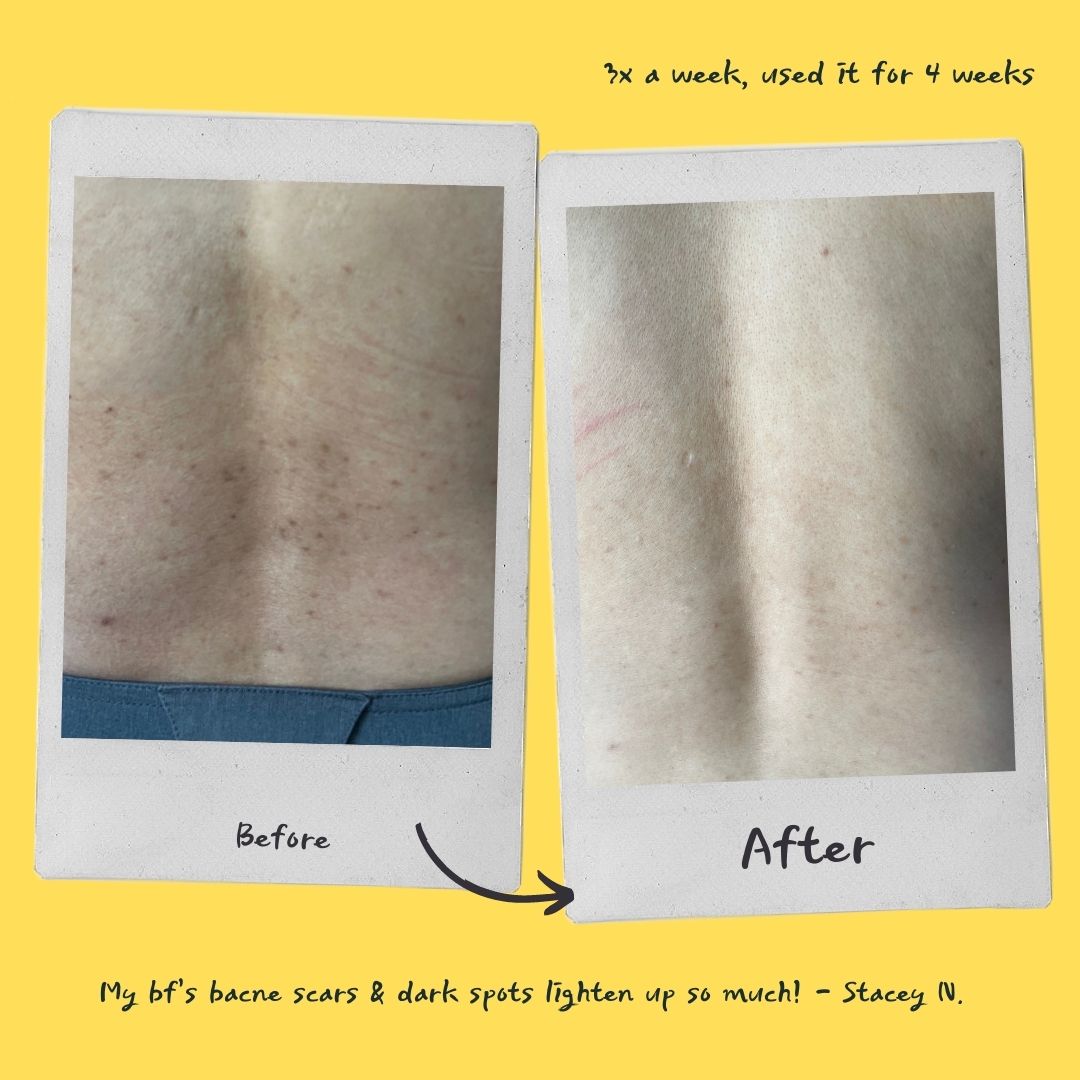 Brightening Exfoliating Mask