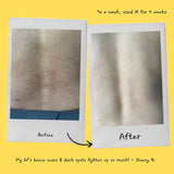 Brightening Exfoliating Mask
